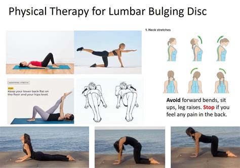 Physical Therapy for a Bulging L5 | Bulging disc, Lower back exercises ...