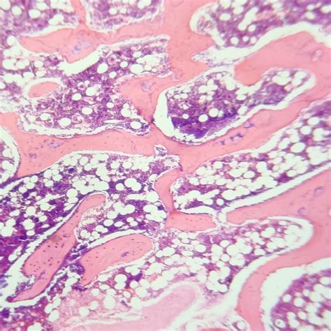 Cancellous bone, also called trabecular or spongy bone, H.E. Stain ...