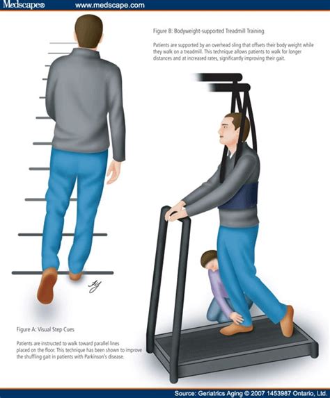 Physical Therapy For Parkinsons Gait - United Health Care Insurance Doctors