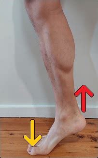 Exercises To Fix Flexor Hallucis Longus Tendonitis - Posture Direct