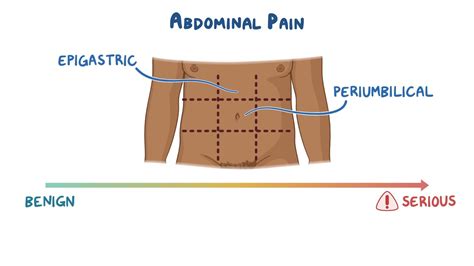 Differential Diagnosis Abdominal Pain Right Lower Quadrant at Samuel ...