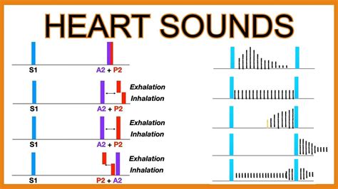 Heart Sounds (Murmurs and Splitting) - YouTube