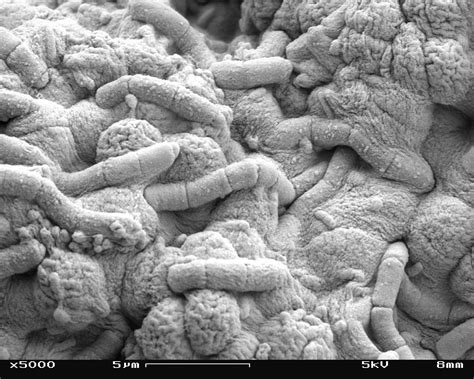 File:Algae and bacteria in Scanning Electron Microscope, magnification ...