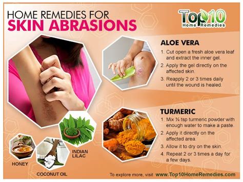 Treating Skin Abrasions at Home: 8 Natural Remedies | Top 10 Home Remedies