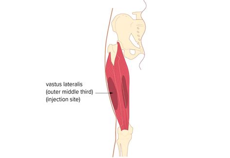 How To Give Subcutaneous Injection In Thigh