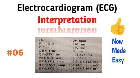 How to Read an ECG (interpretation) | 06 QRS Complex - YouTube