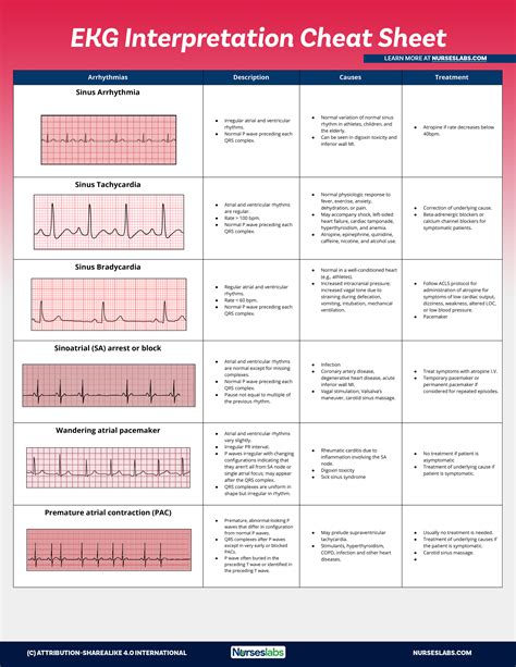 practice ekg rhythm strips for acls