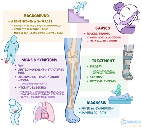 Comminuted Fracture: What Is It, Examples, and More | Osmosis