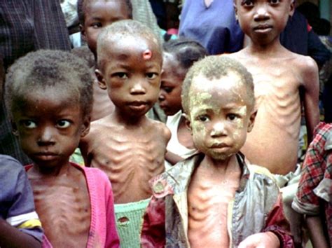 Malnutrition In Northeast Nigeria Has Risen To Horrific Level