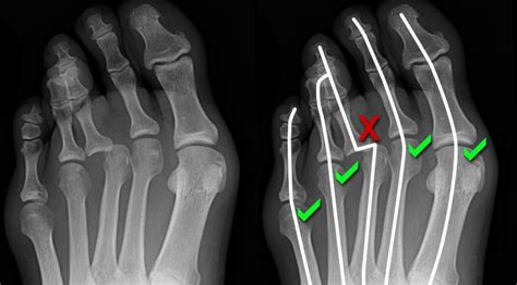 Musculoskeletal X-ray - General principles - Systematic approach