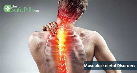 Musculoskeletal Disorders: Here Is An Inclusive Guide