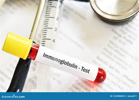 Blood Sample Tube for Immunoglobulin Level Test Stock Photo - Image of ...