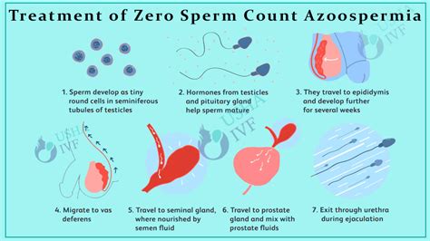 Treatment of zero sperm count Azoospermia | Usha IVF