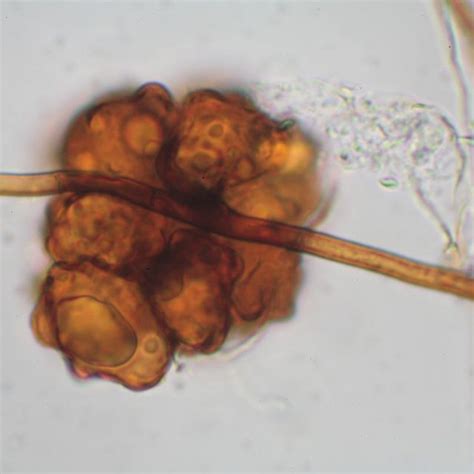 (PDF) The Glomeromycota