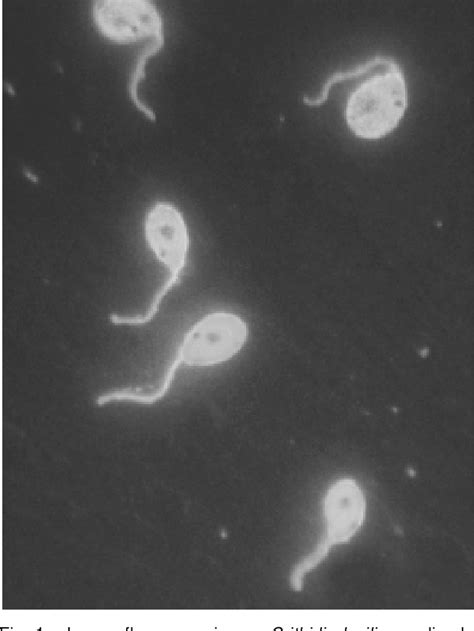 Figure 1 from Inmunofluorescencia con Crithidia luciliae para la ...