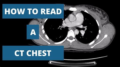 Should You Fast Before A Ct Scan at Dayna Henderson blog