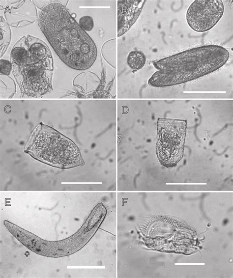 Ciliates Under Microscope