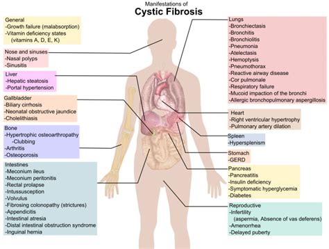 What is Cystic Fibrosis? Its Causes, Symptoms, Pictures and Treatment