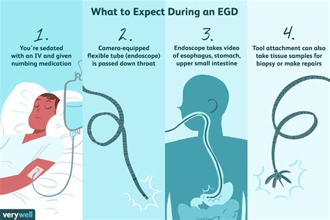 EGD: An Endoscopy to Check the Upper GI Tract