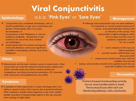 What is Viral Conjunctivitis a.k.a. Sore Eyes? | National Institutes of ...