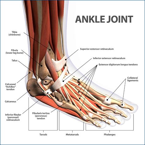 Ankle Fractures Broken Ankle | Florida Orthopaedic Institute | Sprained ...