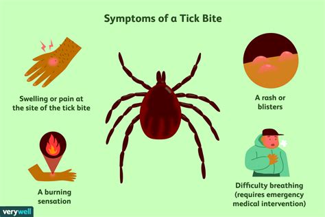 How To Treat Tick Bites