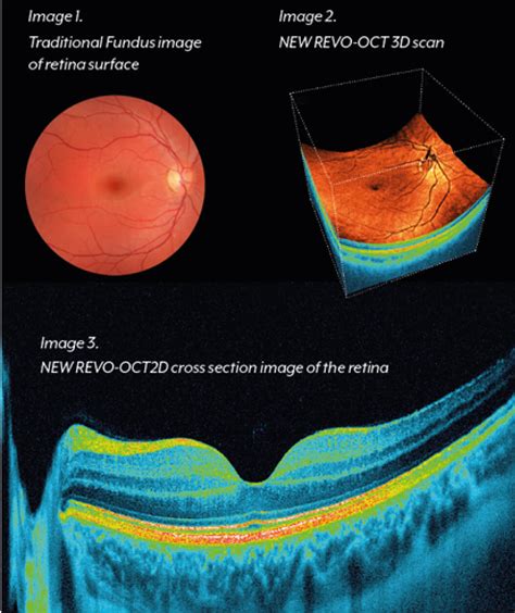 OCT & RETINAL DIGITAL IMAGING - Feltham EyeCare Centre