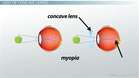 Concave Vs Convex Lens