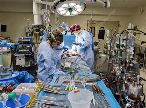 Open heart surgery - Stock Image - C038/0694 - Science Photo Library