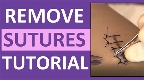 Suture Removal Nursing Skill | How to Remove Surgical Sutures (Stitches ...