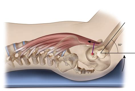 Psoas Major Function: Introduction Muscle Biomechanics | atelier-yuwa ...