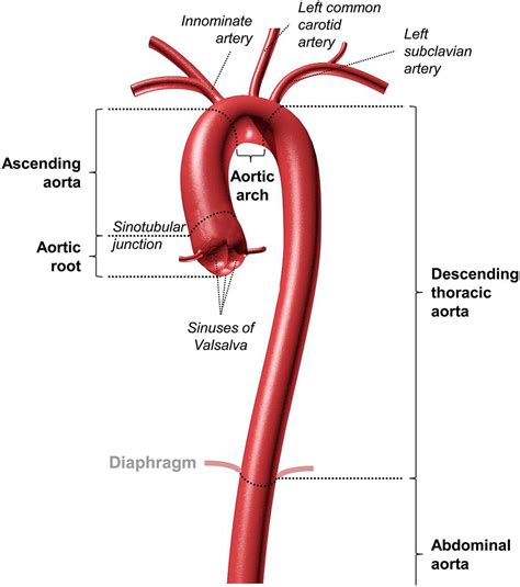 Aortopathies in adult congenital heart disease and genetic aortopathy ...