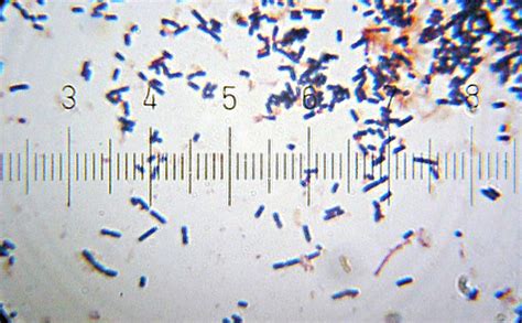 Lactobacillus acidophilus - microbewiki