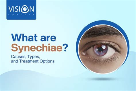 What are Synechiae? Causes, Types, and Treatment Options