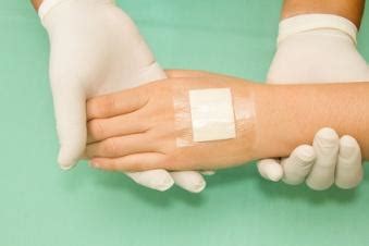 Wound Care Basics: What is an Occlusive Dressing?