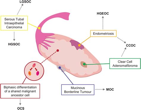 The genesis of different epithelial ovarian cancer... | Download ...