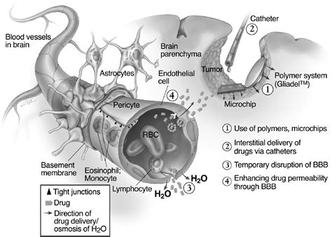 Intratumoral Chemotherapy | Oncohema Key