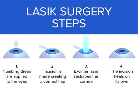 Presbyopia Laser Eye Surgery - Smart Laset Eye Center