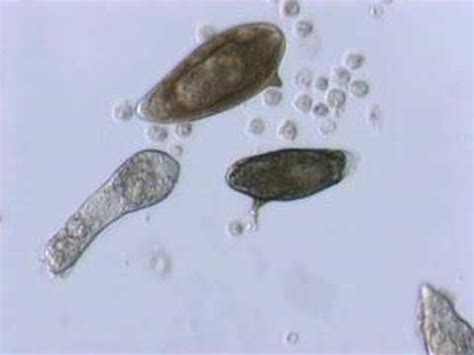 Schistosoma mansoni mother sporocyst and eggs - YouTube