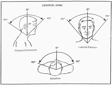 What is the Cervicalgia VA Rating? Here’s 3 Ways to Get a VA Disability ...