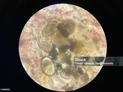 Scabies Notoedres Egg Under The Microscope Stock Photo - Download Image ...