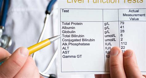 How To Read Your Liver Blood Tests | Cabot Health