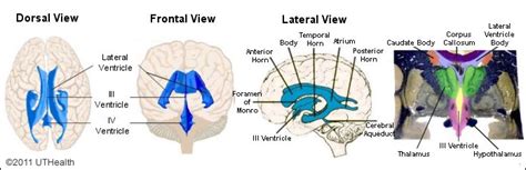 Neuroanatomy Online: Lab 4 (ƒ3) - The Ventricles and Blood Supply - The ...