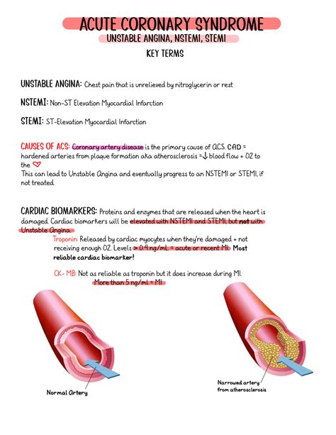 ACS bundle - Notes - Unstable angina, Nstemi, stemi ####### Key terms ...