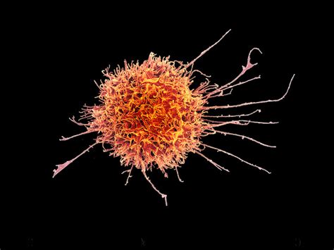 Difference Between Leukocytes and Lymphocytes – Pediaa.Com