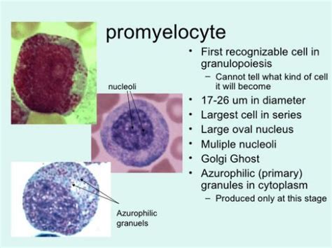 Promyelocyte Vs Myelocyte | galleryhip.com | Medical laboratory science ...