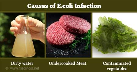 E Coli Infection