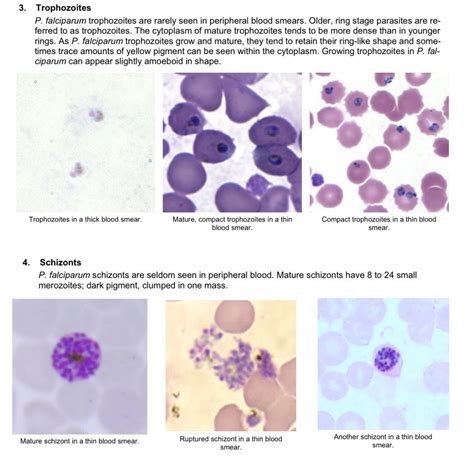 The Life Cycle of Plasmodium Falciparum | Plasmodium Falciparum