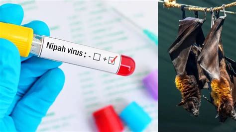 Nipah virus outbreak: Watch out for these 3 risk factors | Health ...