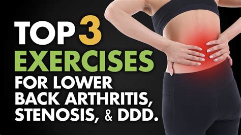 Top 3 Exercises for Lower Back Arthritis, Stenosis, and DDD. - YouTube